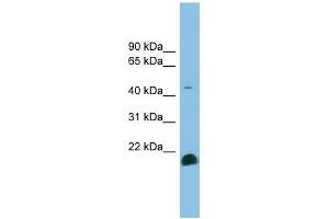 TGF beta 2 antibody used at 1 ug/ml to detect target protein.