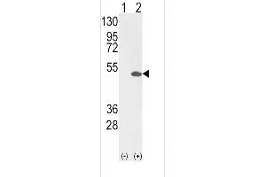 Western blot analysis of ETV4 (arrow) using rabbit polyclonal ETV4 Antibody (C-term) (R). (ETV4 antibody  (C-Term))