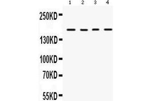 Anti-HKDC1 Picoband antibody, Western blotting All lanes: Anti HKDC1  at 0. (HKDC1 antibody  (N-Term))