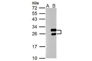WB Image Twist1 antibody [N1C3] detects Twist1 protein by Western blot analysis. (TWIST1 antibody  (Center))