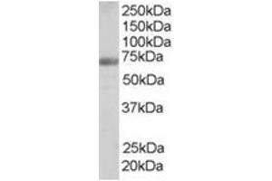 Image no. 1 for anti-Formin Binding Protein 1 (FNBP1) (Internal Region) antibody (ABIN374468) (FNBP1 antibody  (Internal Region))