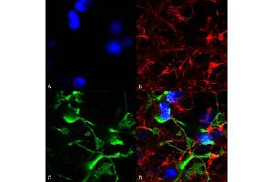 Immunocytochemistry/Immunofluorescence analysis using Mouse Anti-SUR2A Monoclonal Antibody, Clone S319A-14 (ABIN2482971). (ABCC9 antibody  (AA 1505-1546) (Atto 594))