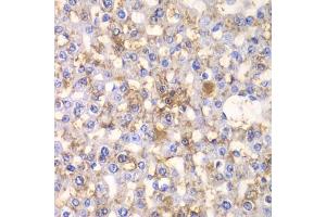 Immunohistochemistry of paraffin-embedded rat liver using H antibody (ABIN6129787, ABIN6141601, ABIN6141603 and ABIN6216048) at dilution of 1:100 (40x lens). (HAPLN1 antibody  (AA 165-354))