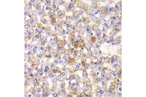 Immunohistochemistry of paraffin-embedded rat liver using H antibody (ABIN6129787, ABIN6141601, ABIN6141603 and ABIN6216048) at dilution of 1:100 (40x lens). (HAPLN1 antibody  (AA 165-354))