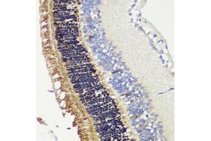 Immunohistochemistry of paraffin-embedded mouse retina using RCVRN antibody (ABIN6128676, ABIN6146832, ABIN6146833 and ABIN6222036) at dilution of 1:200 (40x lens). (Recoverin antibody  (AA 1-200))