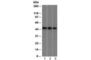 Western blot testing of human 1) Y79, 2) HeLa and 3) HepG2 cell lysate with NSE antibody (clone ENO2/1375).