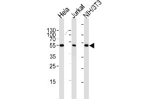 Western blot analysis of lysates from Hela, Jurkat, mouse NIH/3T3 cell line (from left to right), using ARA Antibody (ABIN1944858 and ABIN2838532). (PPARA antibody  (AA 1-468))