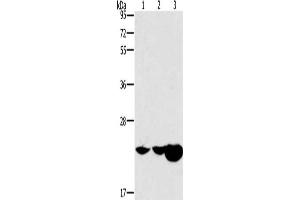 Gel: 10 % SDS-PAGE, Lysate: 40 μg, Lane 1-3: Mouse kidney tissue, Mouse liver tissue, human fetal liver tissue, Primary antibody: ABIN7191000(HRASLS2 Antibody) at dilution 1/362. (HRASLS2 antibody)