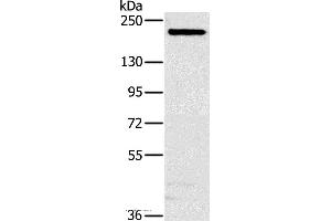 Western blot analysis of Hela cell, using NCOA3 Polyclonal Antibody at dilution of 1:200 (NCOA3 antibody)