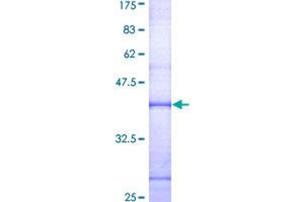 Cathepsin G Protein (CTSG) (AA 146-255) (GST tag)