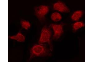 ABIN6274174 staining Hela by IF/ICC. (BRAF antibody  (Internal Region))