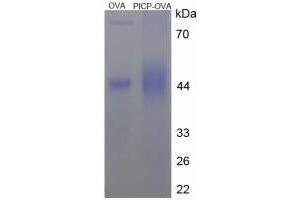 Image no. 2 for Procollagen I C-Terminal Propeptide (PICP) (C-Term) peptide (Ovalbumin) (ABIN5666346) (Procollagen I C-Terminal Propeptide (PICP) (C-Term) peptide (Ovalbumin))