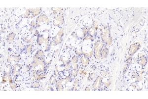 Detection of IL12B in Human Stomach Tissue using Monoclonal Antibody to Interleukin 12B (IL12B) (IL12B antibody  (AA 30-320))