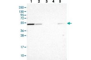 Western blot analysis of Lane 1: RT-4, Lane 2: U-251 MG, Lane 3: Human Plasma, Lane 4: Liver, Lane 5: Tonsil with NSUN7 polyclonal antibody  at 1:100-1:250 dilution. (NSUN7 antibody)