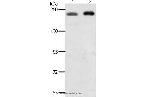 Western blot analysis of Hela and Jurkat cell, using SMARCA4 Polyclonal Antibody at dilution of 1:700 (SMARCA4 antibody)