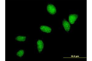 Immunofluorescence of monoclonal antibody to UBE2C on HeLa cell. (UBE2C antibody  (AA 1-179))