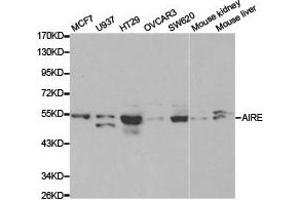 Western Blotting (WB) image for anti-Autoimmune Regulator (AIRE) antibody (ABIN1870889) (AIRE antibody)