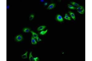 Immunofluorescence staining of HepG2 cells with ABIN7162667 at 1:108, counter-stained with DAPI.
