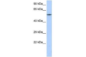 Western Blotting (WB) image for anti-Calcium Channel, Voltage-Dependent, beta 1 Subunit (CACNB1) (C-Term) antibody (ABIN2774675)