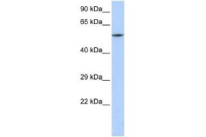 WB Suggested Anti-CACNB1 Antibody Titration:  0. (CACNB1 antibody  (C-Term))