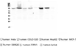 Western blot analysis of beta Catenin using anti-beta Catenin antibody . (CTNNB1 antibody  (AA 2-233))