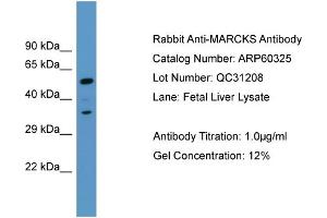 Western Blotting (WB) image for anti-Myristoylated Alanine-Rich Protein Kinase C Substrate (MARCKS) (C-Term) antibody (ABIN786131) (MARCKS antibody  (C-Term))
