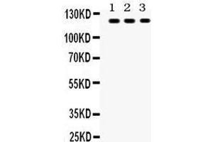 Anti- TLR7 Picoband antibody, Western blotting All lanes: Anti TLR7  at 0. (TLR7 antibody  (C-Term))