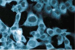 Immunofluorescent staining of ES2 cells. (STRAP antibody  (AA 42-154))