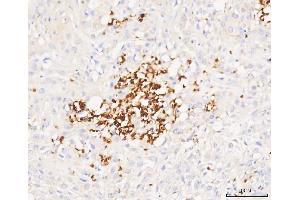 IHC analysis of Grancalcin/GCA using anti-Grancalcin/GCA antibody (ABIN6719568).