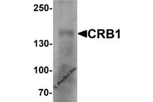 Western Blotting (WB) image for anti-Crumbs Homolog 1 (CRB1) antibody (ABIN1077415) (CRB1 antibody)