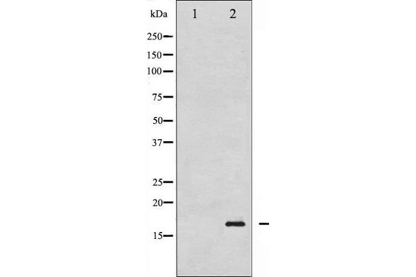 Histone H3.1 Antikörper  (pSer10)