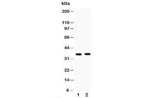 Western blot testing of HSD17B6 antibody and Lane 1:  human placenta;  2: MCF-7;  Predicted size: 35KD;  Observed size: 35KD (HSD17B6 antibody  (C-Term))