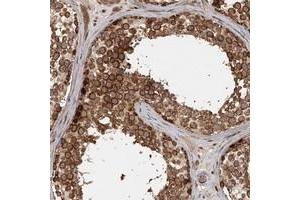 Immunohistochemical staining of human testis with FAXC polyclonal antibody  shows strong cytoplasmic positivity in cells in seminiferus ducts at 1:200-1:500 dilution.