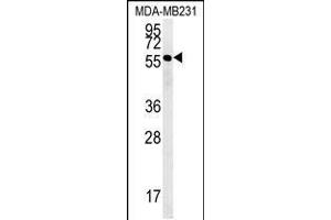 Western blot analysis in MDA-MB231 cell line lysates (35ug/lane). (RAB11FIP2 antibody  (AA 345-374))