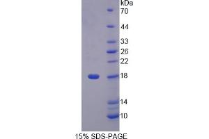 Image no. 1 for Lipocalin-Like 1 (LCNL1) (AA 2-164) protein (His tag) (ABIN6240013) (LCNL1 Protein (AA 2-164) (His tag))