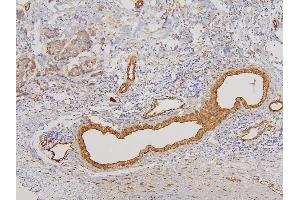 IHC analysis of RAB3GAP2 using anti-RAB3GAP2 antibody (ABIN6719633).