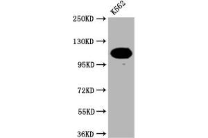 Western Blot Positive WB detected in: K562 whole cell lysate All lanes: PARP antibody at 1:2000 Secondary Goat polyclonal to rabbit IgG at 1/50000 dilution Predicted band size: 114 KDa Observed band size: 114 kDa (Recombinant PARP1 antibody)