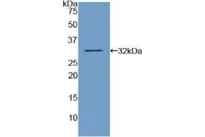 Detection of Recombinant AMY2, Human using Polyclonal Antibody to Amylase, Alpha 2A (AMY2A) (AMY2A antibody  (AA 188-432))