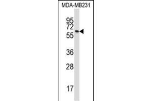 BTN3A1 Antibody (C-term) (ABIN657422 and ABIN2846459) western blot analysis in MDA-M cell line lysates (35 μg/lane). (BTN3A1 antibody  (C-Term))