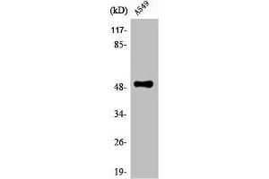 Western Blot analysis of A549 cells using CPM Polyclonal Antibody (CPM antibody  (Internal Region))
