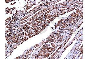 Formalin-fixed and paraffin embedded mouse heart tissue with Anti-CTn1/Troponin I/TNNC1 Polyclonal Antibody, Unconjugated (ABIN728308) at 1:200, followed by conjugation to the secondary antibody and DAB staining