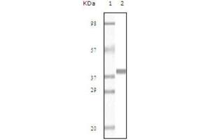 Western blot analysis using Myoglobin antibody against truncated Myoglobin recombinant protein (AA: 2-154). (Myoglobin antibody)