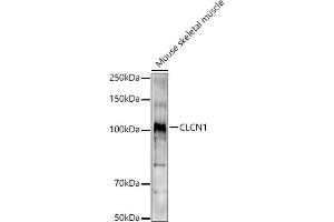 Western blot analysis of extracts of Mouse skeletal muscle, using CLCN1 antibody (ABIN6130939, ABIN6138661, ABIN6138662 and ABIN6221409) at 1:1000 dilution. (CLCN1 antibody  (AA 779-988))