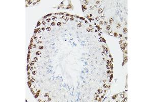 Immunohistochemistry of paraffin-embedded rat testis using CPSF6 Rabbit pAb (ABIN6128924, ABIN6138974, ABIN6138975 and ABIN6221646) at dilution of 1:100 (40x lens). (CPSF6 antibody)