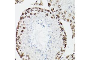 Immunohistochemistry of paraffin-embedded rat testis using CPSF6 Rabbit pAb (ABIN6128924, ABIN6138974, ABIN6138975 and ABIN6221646) at dilution of 1:100 (40x lens). (CPSF6 antibody)