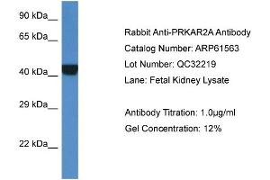 Western Blotting (WB) image for anti-Protein Kinase, CAMP-Dependent, Regulatory, Type II, alpha (PRKAR2A) (Middle Region) antibody (ABIN2788839) (PRKAR2A antibody  (Middle Region))