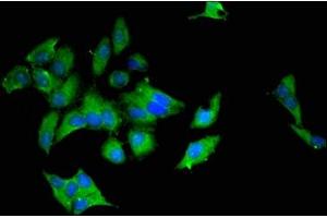 Immunofluorescent analysis of Hela cells using ABIN7174579 at dilution of 1:100 and Alexa Fluor 488-congugated AffiniPure Goat Anti-Rabbit IgG(H+L)