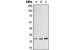 Western blot analysis of MRPL12 expression in HeLa (A), SP2/0 (B), H9C2 (C) whole cell lysates. (MRPL12 antibody  (Center))