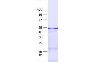 ZNF621 Protein (His tag)
