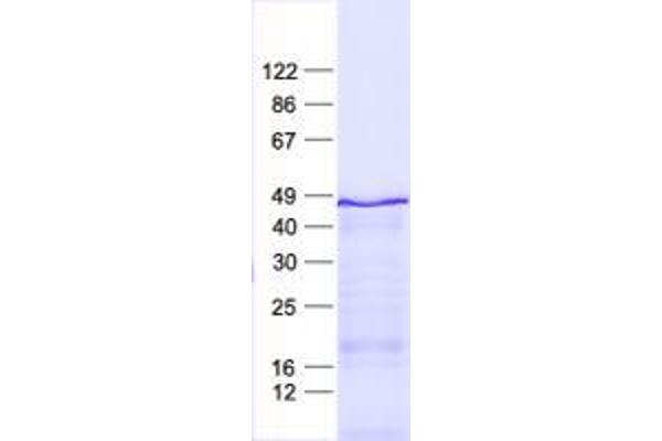 ZNF621 Protein (His tag)